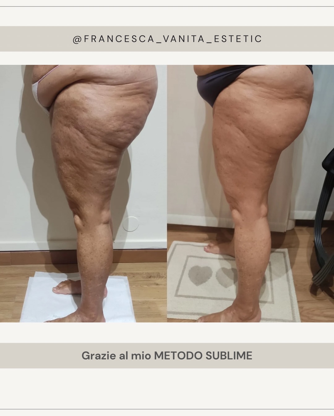 Risultato trattamento 1 – Vanità Estetic